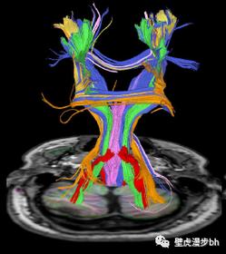 image sensor dti技术