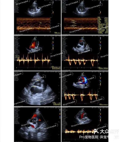 PerformTek心率技术如何精准监测心率？-图3
