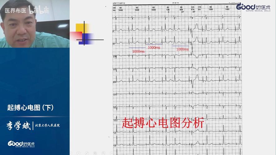 PerformTek心率技术如何精准监测心率？-图2