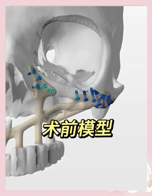 3D打印医学应用突破与挑战有哪些？-图3