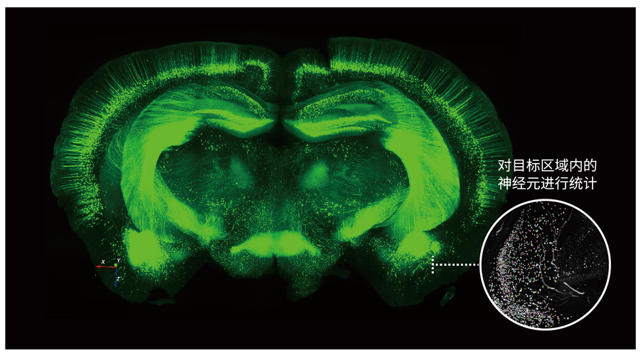 Clear-Vu显示技术如何实现视觉增强？-图1