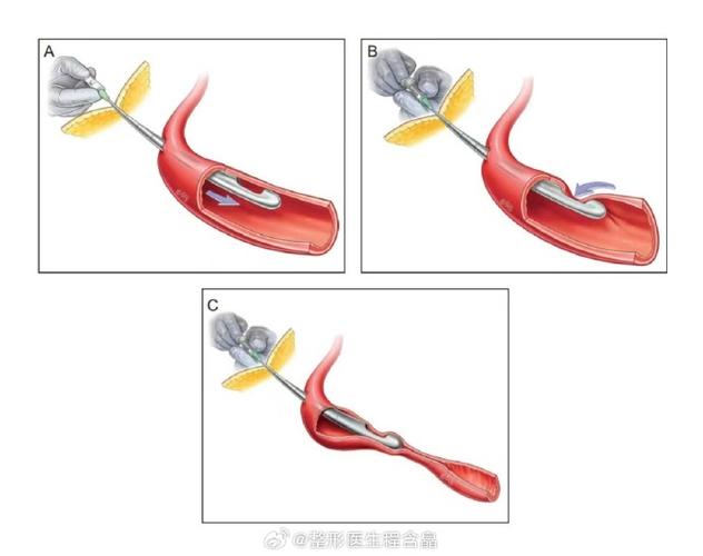 Roob多感觉刺激技术具体指什么？-图3