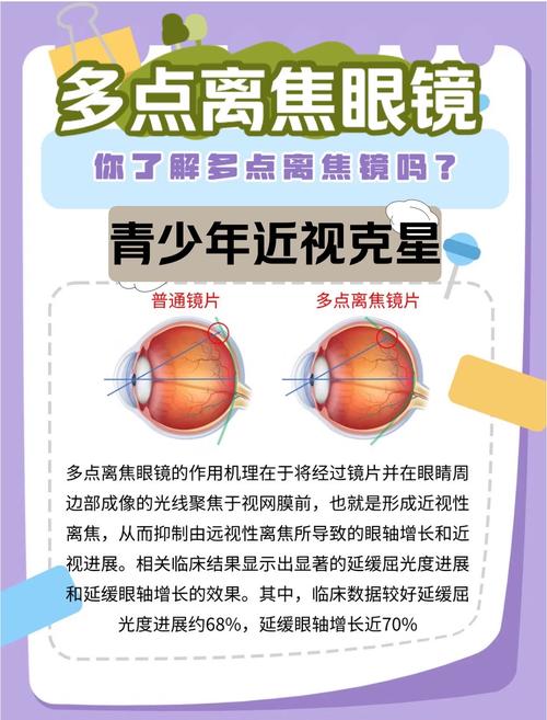 Vaunt智能眼镜无需屏幕，它是如何将信息直接投射进视网膜的？-图2