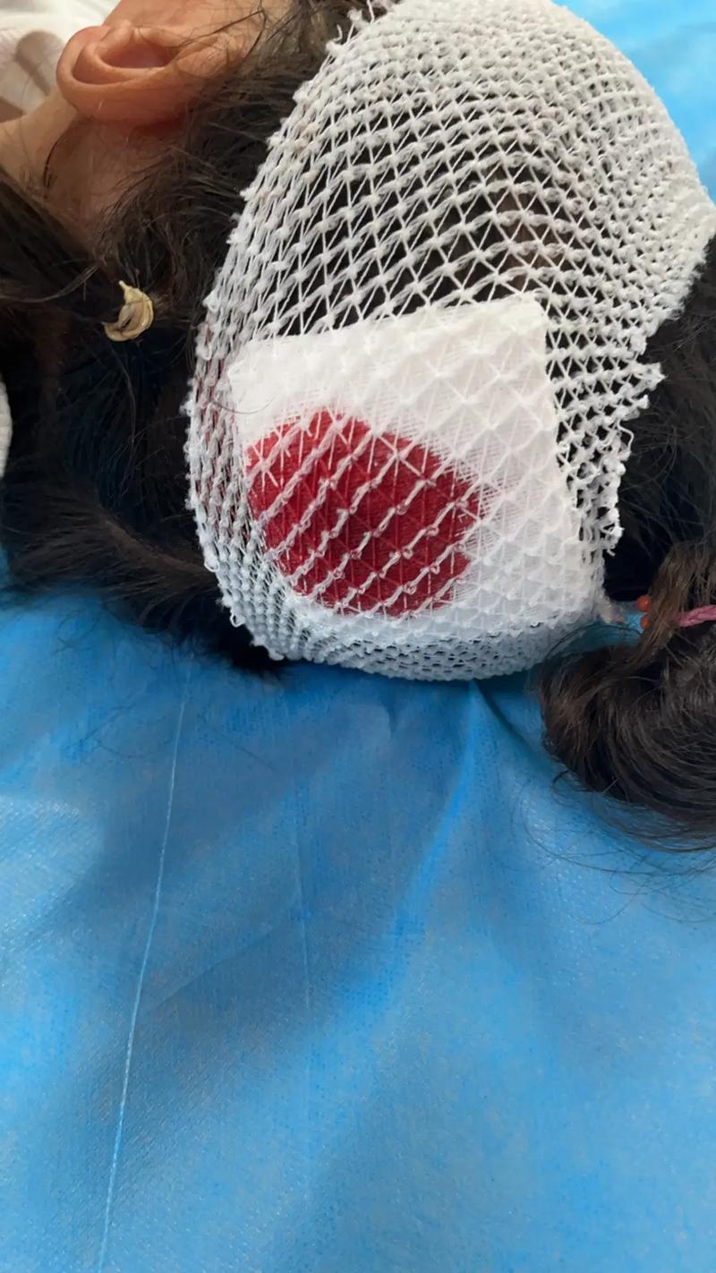 Dobby无人机伤人，谁该担责？-图2